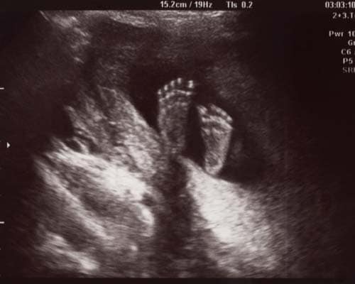 Vorgeburtliche Bindung Vorgeburtliche Bindung